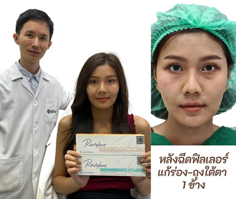 ฉีดใต้ตาคล้ำ