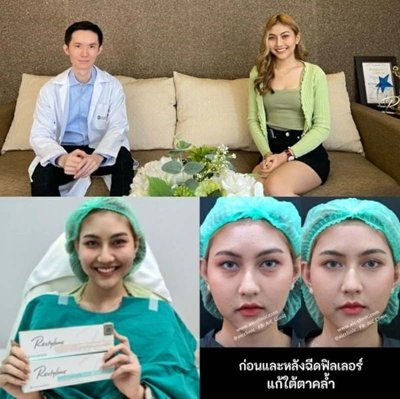 ฉีดถุงใต้ตา